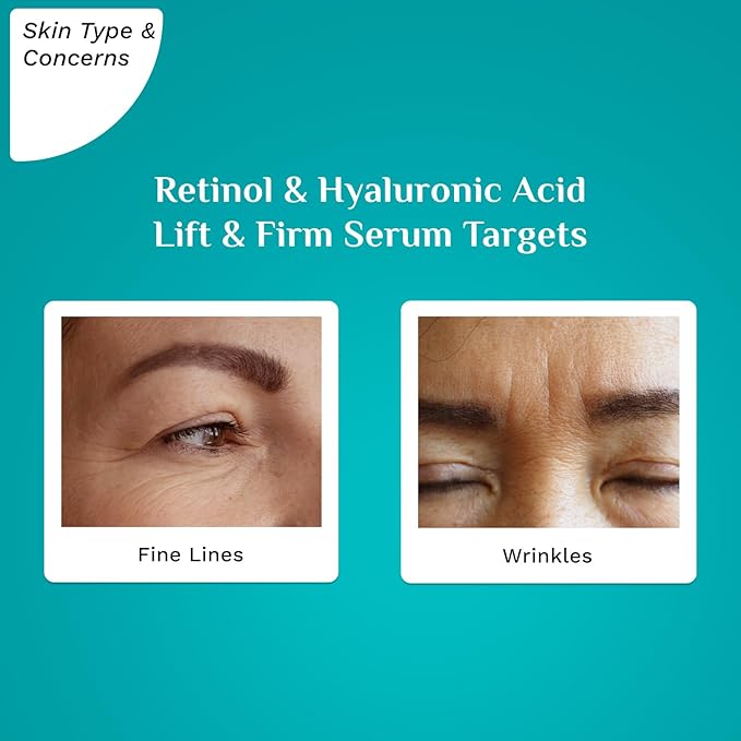 Lift & Firm Face Serum | Retinol & Hyaluronic Acid Anti Aging Serum | Firms Skin, Smooths Fine Lines, Restores Elasticity & Radiance | Lightweight & Fast Absorbing | 1.01 Fl Oz (30ml)