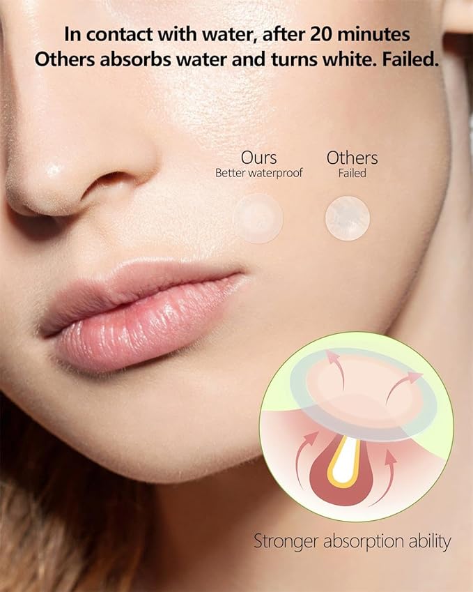 Beviliu Pimple Patches for Face 66 Counts, 2 Sizes Thinner Edge Hydrocolloid Acne Patches, Invisible Zit Patches for Face, Facial Skin Care Products Beauty