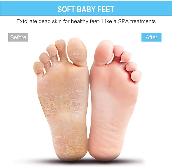 BESKAR Larger Foot Scrubber Mat with Non-Slip Suction Cups- Cleans, Smooths, Exfoliates & Massages Without Bending, Circulation & Soothes Tired Feet, Great for Shower or Bathtub