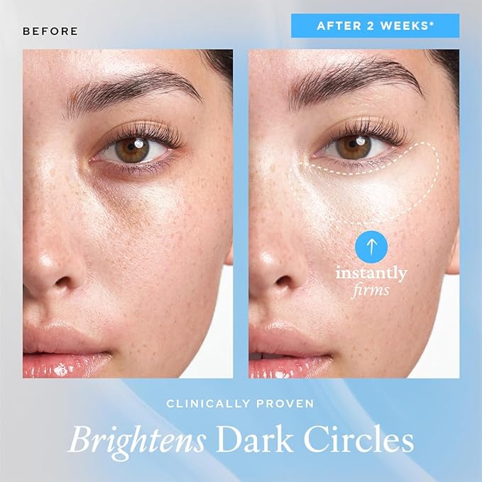 belif Aqua Bomb Cooling Eye Gel - Caffeine & Hyaluronic Acid for Puffiness & Hydration, Niacinamide & Vitamin C for Dark Circles, Adenosine & Collagen for Plumping & Firming, Korean Skin Care