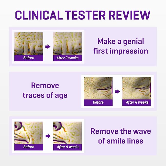 SOME BY MI Retinol Intense Reactivating Serum 50ml + Retinol Intense Advanced Triple Action Eye Cream