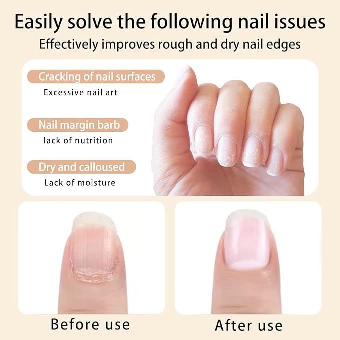 18Pcs Nail Cuticle Oils Nail Nutrition Oil Pen Nail Nourishment Pens 18Smell Cuticle Revitalizer for Agnail Nourish Skin Nail Care