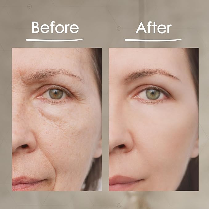 MaxiLift Serum, Instant Face Lift Cream, Skin Serum for Face & Instant Eye Lift, Smooth & Firm Loose Sagging Skin, Fine Lines & Wrinkles Within 2 Minutes, 0.5 Fl Oz (Set of 2)