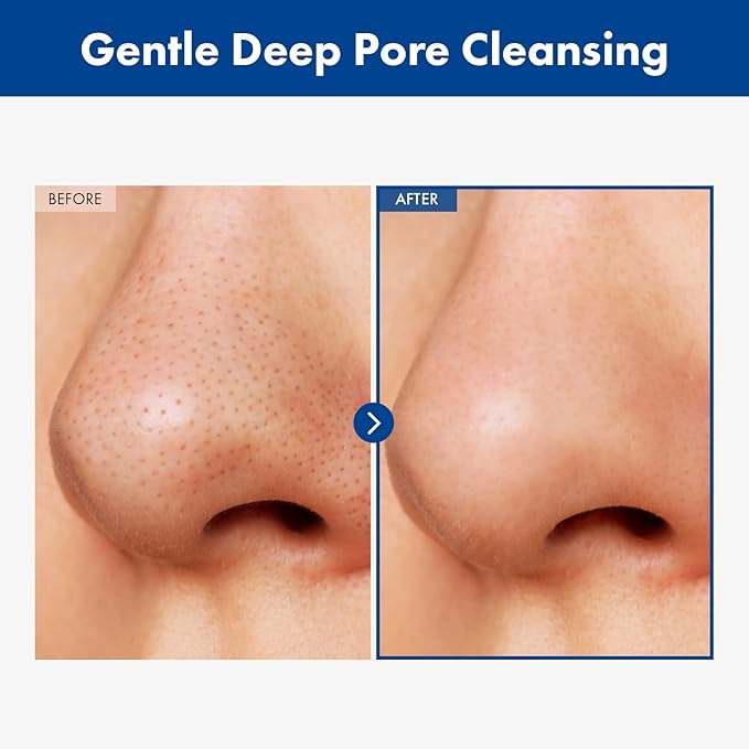 AHA Blackhead Out Cleansing Oil, Jojoba Oil, Makeup Remover, Blackhead & Pore Cleaner, Gentle Face Cleanser, Korean Skincare, 150ml, 5.07 fl. oz.