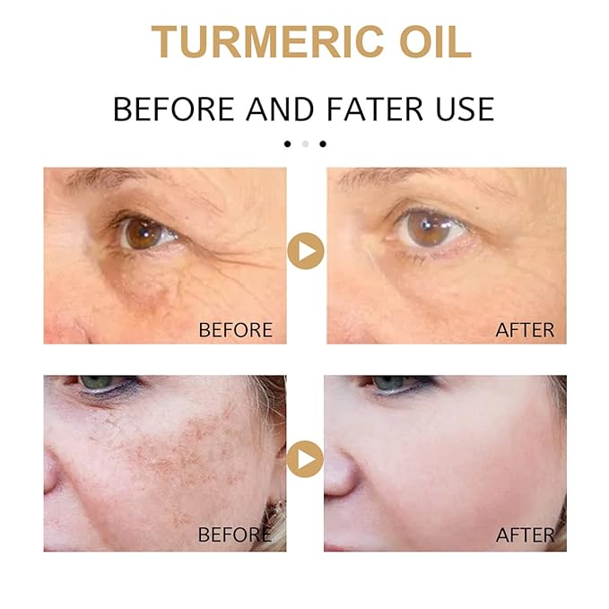 2Pack Turmeric Corrector Serum, Natural Turmeric Repair Face Serum for Face, Hydrate and Dry Skin