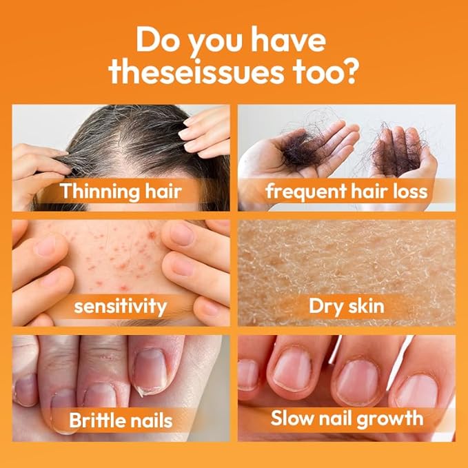 Biotin 10000 mcg with Zinc, Vitamin C & Calcium Pantothenate – Supports Healthy Hair Growth, Strong Nails & Glowing Skin for Women & Men | Made in The USA | 120 Vegan Capsules (4 Months Supply)