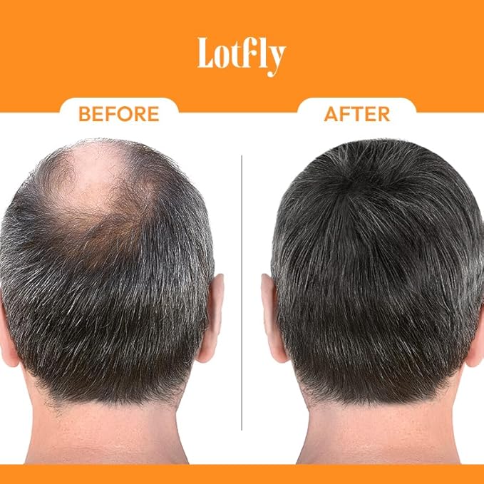 Biotin 10000 mcg with Zinc, Vitamin C & Calcium Pantothenate – Supports Healthy Hair Growth, Strong Nails & Glowing Skin for Women & Men | Made in The USA | 120 Vegan Capsules (4 Months Supply)