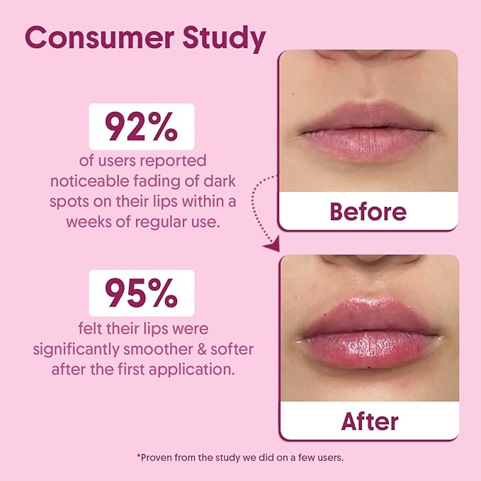 Beetroot Lip Scrub with Shea Butter & Cocoa Butter – For Dark, Chapped & Pigmented Lips – Suitable for Men and Women - 0.5 FL Oz / 15gm