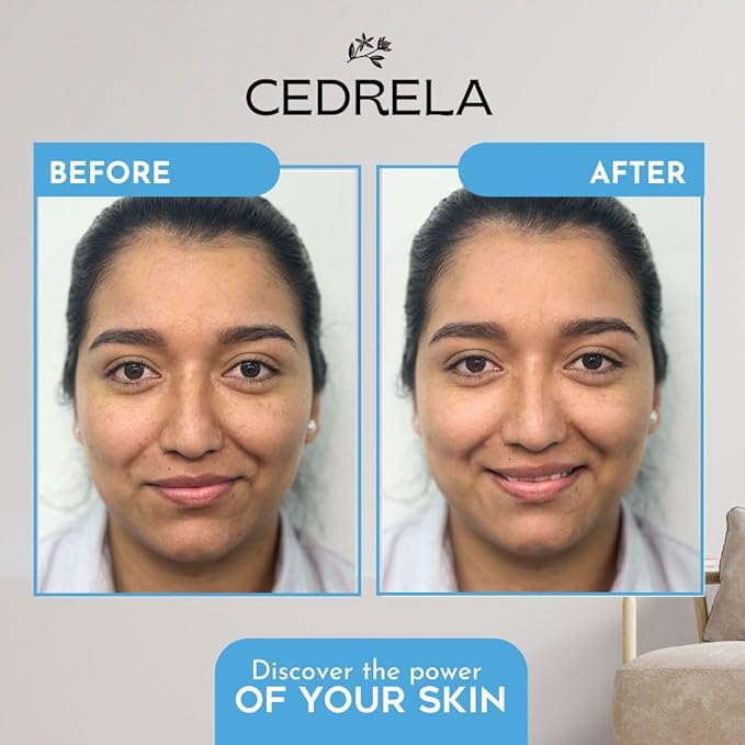 Cedrela Hydra-protect serum Day Night Nourishing Repair Prebiotics Probiotics Bioemulsion Calendula Chamomile Aloe Vera Cacay Oil Vegan All-natural 1 fl oz Suero hidratante probioticos