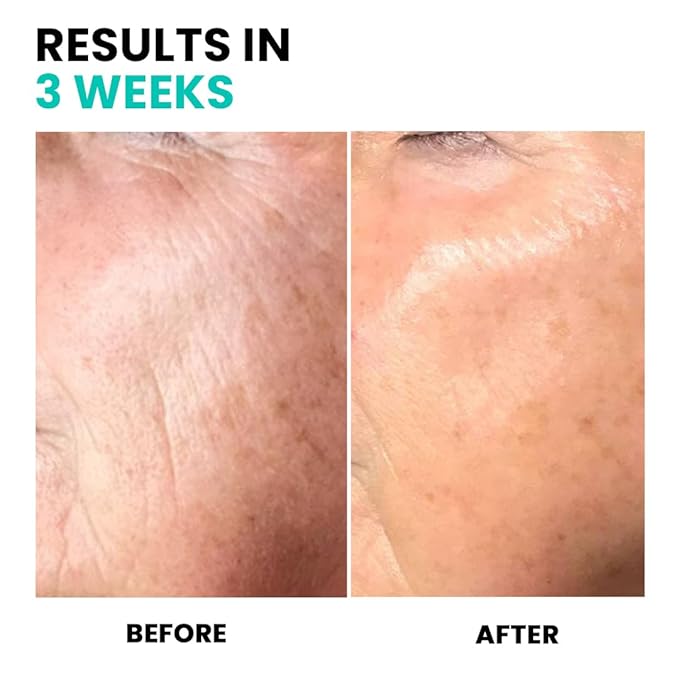 Conatural Anti-Aging Serum 30ml - Face Serum for Wrinkles & Fine Lines, Peptide, Tightening Serum for Deep Wrinkles, Anti-Aging Treatment, Fine Lines Remover for Youthful Skin