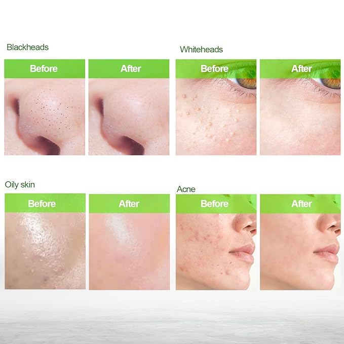 Blackhead Remover Mask, Charcoal Peel Off Face Mask, Blackhead Remover, Pore Cleaner for Men & Women, 2.7 fl oz