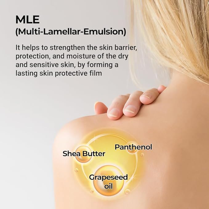 Derma B | AC Control Body Lotion | Moisturizer for Anti-Blemish & Pimples | Water-Oil Control | Hypoallergenic Solution for All Skin Types | Body Cream for Soothing & Refreshing | 13.52 fl oz (400ml)