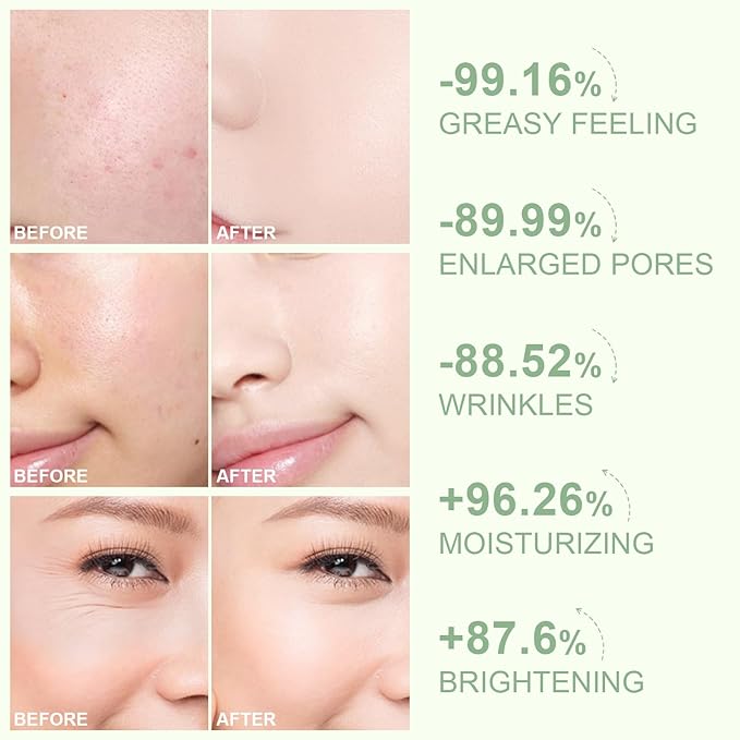 6pcs Avocado Skincare Set, Skin Care Gift Set with Facial Cleanser, Toner, Face Serum, Face Cream, Eye Cream For Hydrating Skin, Anti-Aging Skin For Women Teen Girls (Avocado)