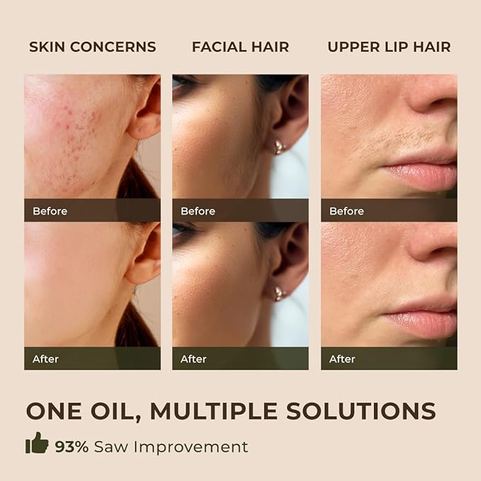 Gya Labs Spearmint Essential Oil for Facial Hair - Huge 4 Fl Oz - 100% Pure Natural Spearmint Oil for Diffuser, Skin, Massage, Aromatherapy & Candle Making Scent