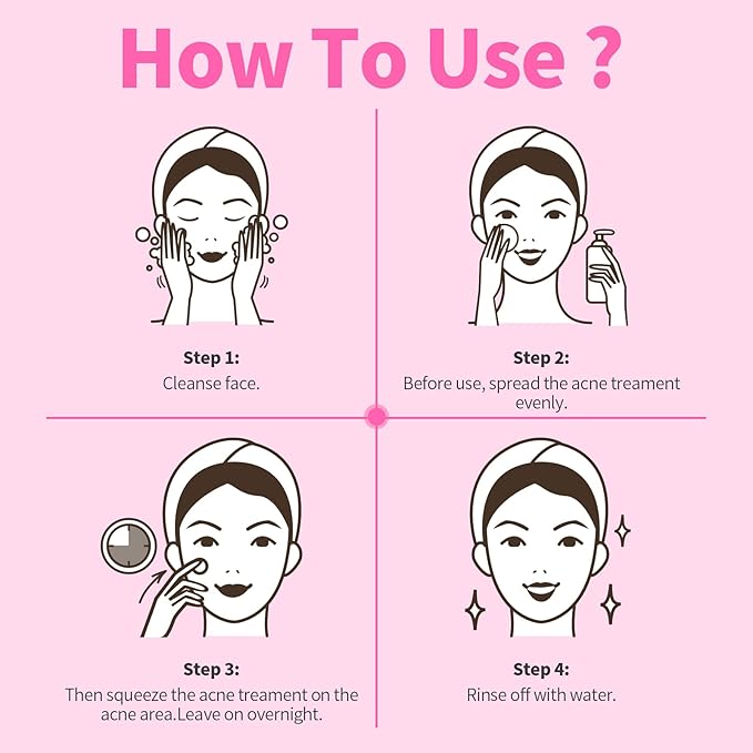 Acne Serum for Face, Back and Body, Gentle Skin Care for Acne Prone Sensitive Skin | For Women & Men