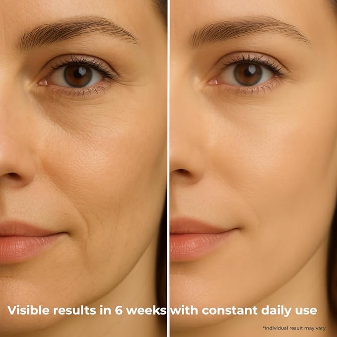 Biotech Eye & Lip Contour Cream — Hyaluronic Acid Spheres + Tamanu Oil — Depuffs, Plumps & Smooths Fine Lines — Ophthalmologically & Dermatologically Tested