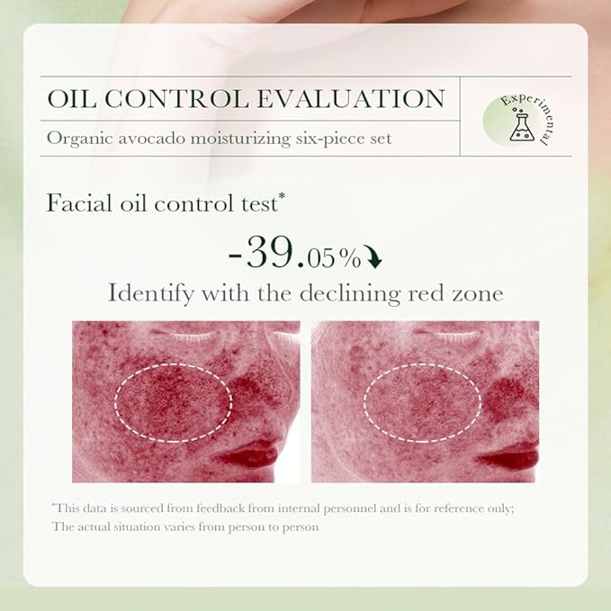 11pcs Avocado Skincare Kit, Skin Care Gift Set with Lip Balm, Toner, Lotion, Face Serum, Eye Cream For Hydrating Skin, Anti-Aging Skin For Women Teen Girls