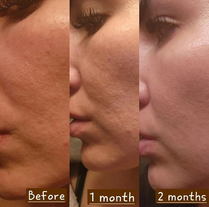 Rejuvenating Facial Night Cream with Retinol, Tepezcohuite, Niacinamide - cruelty-free, vegan, paraben-free silicone-free Mexican Natural skincare ingredients