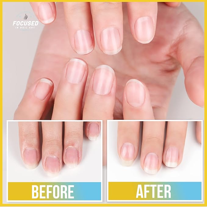 Teenitor Cuticle Remover Cuticle Remover Kit, Nail Care Kit with Cuticle Remover Cuticle Oil Nail File Nail Buffer Cuticle Pusher, Cuticle Peeler Scraper, Manicure Care Tools Milk and Honey