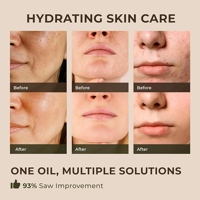 Gya Labs Frankincense Essential Oil for Face - 0.34 Fl Oz - 100% Pure Natural Frankincense Oil for Skin, Body Massages & Candle Making - Premium Grade for Wellness & Comfort - Woody & Calming Scent