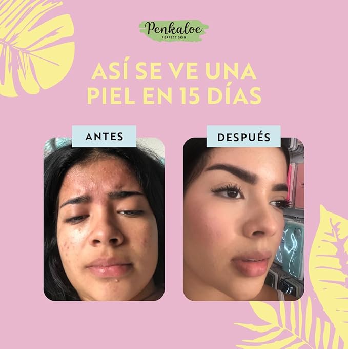 Penkaloe Aloe Skincare Kit | Cuidado Natural para la Piel, Control de Grasa y Mejora de la Apariencia | Aloe Skincare Routine – 3-Step Natural Solution for Fresh, Radiant Skin – Hydrates & Balances