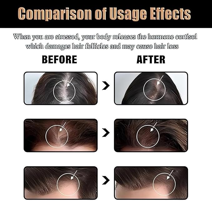 Shampoo, Root Activating Shampoo, Hair Thickening Shampoo，Natural Hair Regrowth Shampoos for Men Women(100ML)