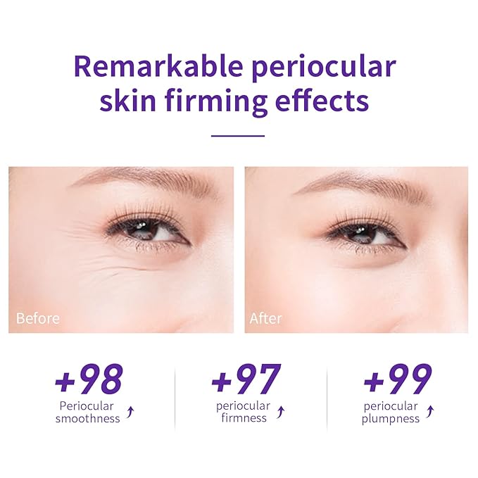 LANBENA Under Eye Cream, Retinol Eye Cream for Dark Circles and Puffiness, Daily Anti-Aging Under Eye Cream with Retinol & Hyaluronic Acid to Fight Fine Lines and Firm Skin (0.68 FL OZ)