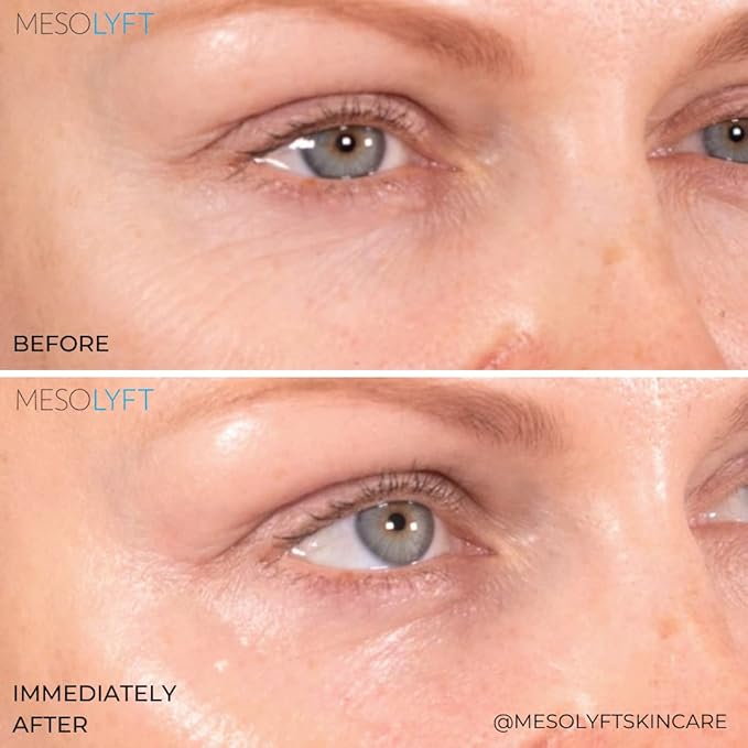 Neck & Eyes Combo Skincare Tool under Eye Serum With Neck Line Remover Neck and Décolletage Beuty Tool & Under Eye Wrinkle Filler Exfoliates the Skin, Visibly Firm & Smooth Necklines