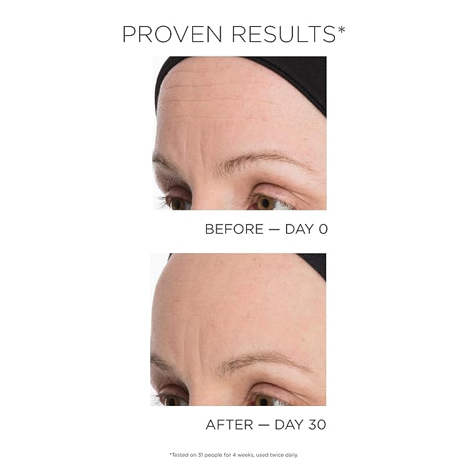 IDC Dermo Express Multi-Action 16-In-1 Anti Aging & Antioxidant Cream - 1,7 fl oz - Anti Aging Face, Eyes & Neck Cream Moisturizer for Wrinkles - Vegan Antiaging Moisturizer Cream for Men & Women