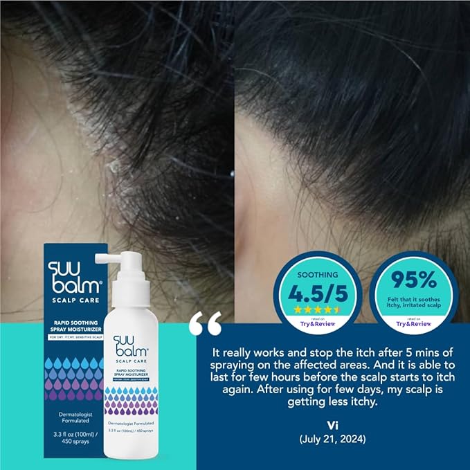 Scalp Care, Rapid Soothing Scalp Relief Spray Moisturiser Treatment, Itchy Scalp Treatments, Spray for Itchy Dry Scalp, Leave In Treatment for Itchy, Sensitive skin, Derm-Formulated,1.35 fl oz