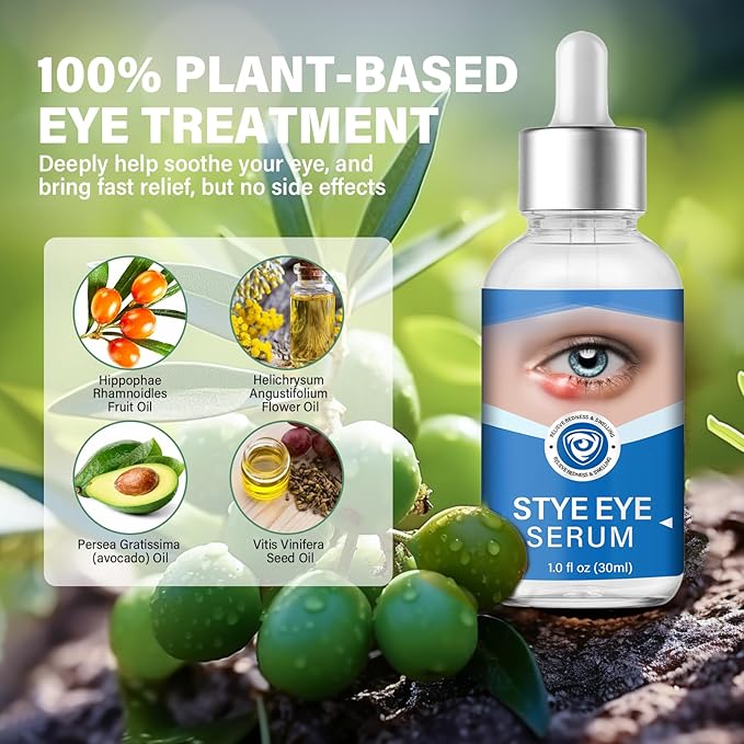 Stye Eye Treatment, Gently Cleanses Lashes and Eyes, Restore Healthier Eye Skin, 30 ml