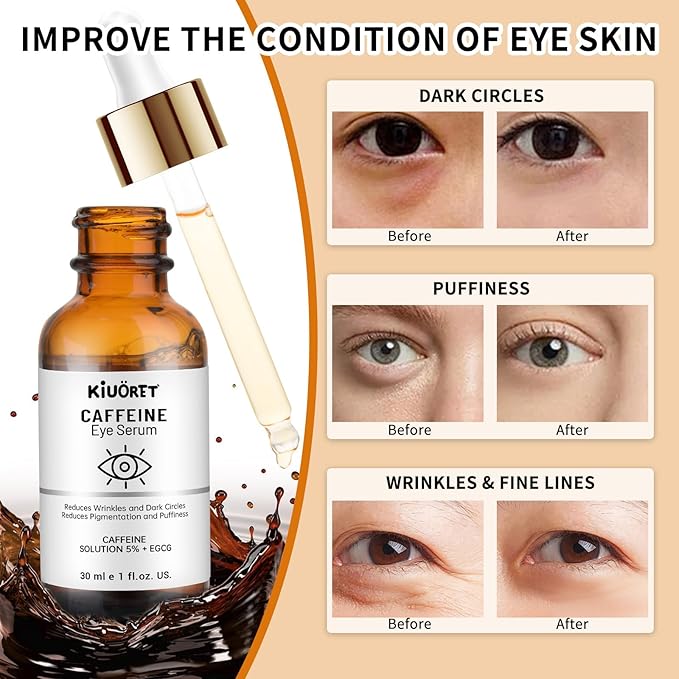 Caffeine Eye Serum with EGCG, 2 PCS 5% Caffeine Solution Reduces Pigmentation and Puffiness, Under Eye Serum for Dark Circles, Wrinkles and Fine Lines