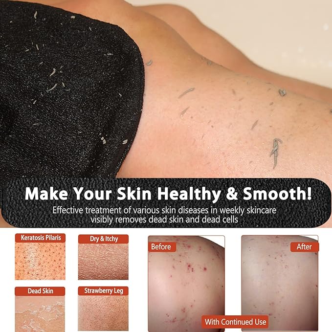 【2 in 1】Exfoliating Glove and Microfiber Hair Towel Set, Deep Exfoliating Body Scrubber for Healthy Skin Korean Exfoliating Mitt, Skin Body Exfoliator,【Super Absorbort】Hair Towel for Women Wet Hair