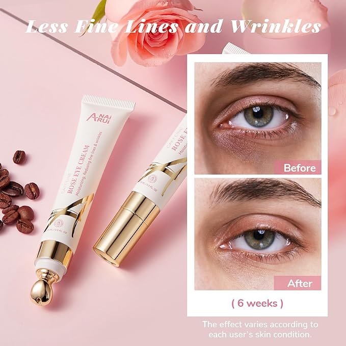 ANAI RUI Rose Caffeine Eye Cream for Dark Circles, Mother's Day Gift for Women, Anti-Aging Eye Cream with Retinol, Collagen, Hydrating, Firming, Reduce Wrinkles and Fine Lines Daily 0.5 FL OZ