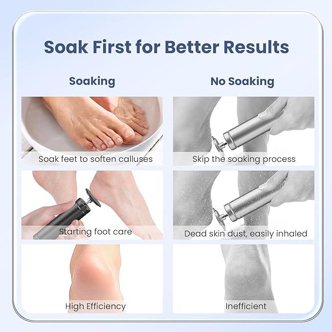 Electric Callus Remover for Feet, Adjustable Speed Foot Callus Remover, Professional Pedicure Tools for Feet with 60 Pcs Replacement Sandpaper Disc, Foot Scrubber for Dead Skin and Calluses