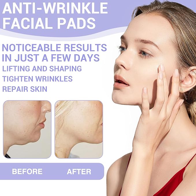 108PCS Smile Line Wrinkle Patches, Facial Frown Crows Feet Wrinkle Patches