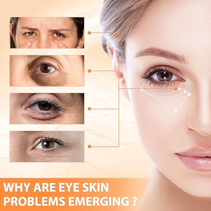 2PCS Revive Glow Vitamin C Eye Balm, Reducing Dark Circle,Hydrating Eye Cream,Improve Dark Circles,Reduces Puffiness (3pcs)