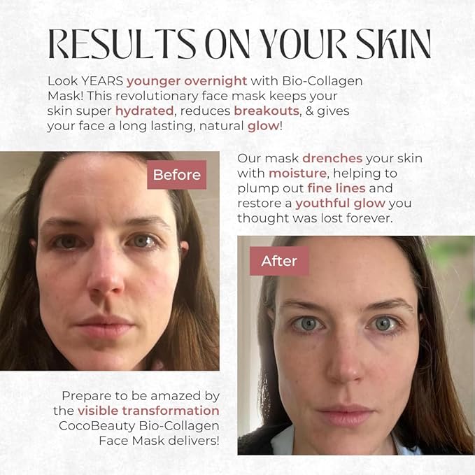 Bio Collagen Face Mask – Hydrating & Anti-Aging Korean Collagen Sheet Masks, Deep Hydration, Smooths Fine Lines, Overnight Face Mask for Radiant Skin (4 pcs)