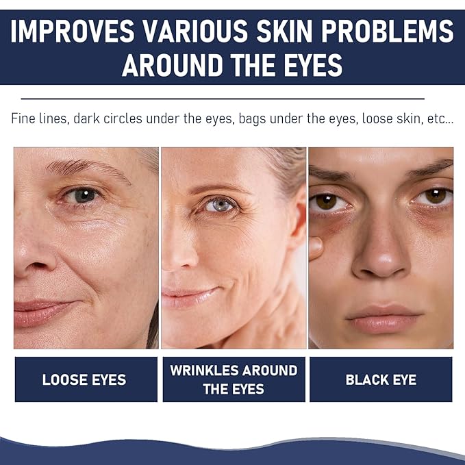 Rapid Reduction Eye Serum, Advanced Formula Instant Eye Serum, Anti Aging Serum Visibly Reduces Under-eye Bags, Nourishing Eye Serum, Suitable For All Skin Type (2Pcs)