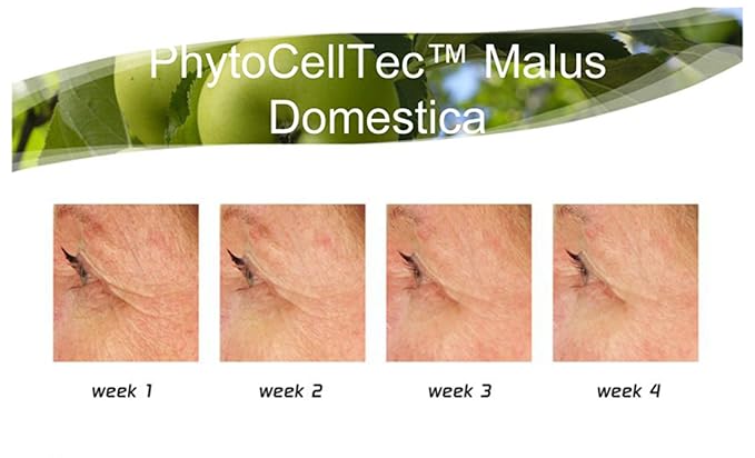 Anti-Aging. DIY Swiss Apple Stem Cell 100% Serum Booster. Remove Wrinkles, Rebuild Collagen & Elastin