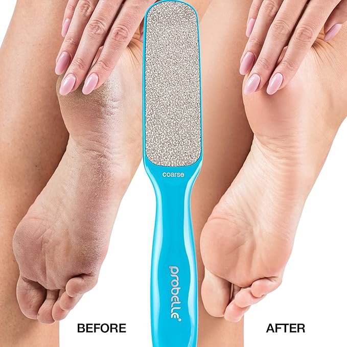Probelle Double Sided Multidirectional Nickel Foot File Callus Remover - Immediately Reduces calluses and Corns to Powder for Instant Results, Safe Tool (Blue)