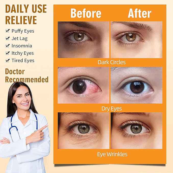 Serfeymi 22 Packs Steam Eye Mask, Warming Eye Mask Promote Sleep Eye Patch Self-Heating, Disposable Eye SPA Heated Eye Mask for Dry Eyes, Dark Circles, Tired Eyes, Eye Fatigue (Upgraded Chamomile)