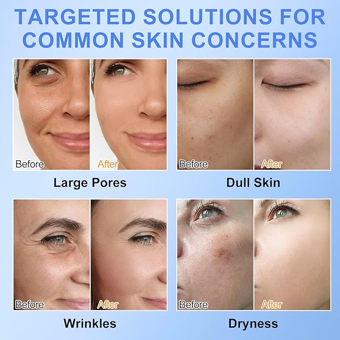 Collagen Face Mask, (6PCS) Bio-Collagen Real Deep Mask, Deep Collagen Anti Wrinkle Lifting Mask with Low Molecular Weight Collagen for Pore Minimizing, Firming and Moisturizing