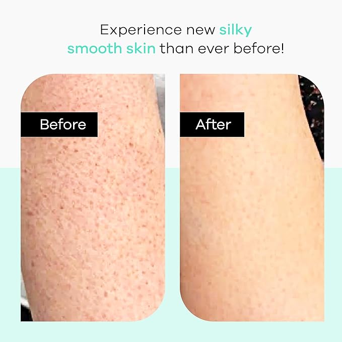 Dermasuri Exfoliating Body Lotion - Grapefruit KP Bump Eraser Body Scrub - Rough and Bumpy Textured Skin Lotion - Moisturizer for Dry Skin and Body - Hydrating Care Treatment, Travel Size - 4 Ounces