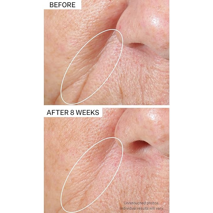 StriVectin Tighten and Lift Peptight Tightening and Brightening Face Serum with Peptides for Even Skin Tone, 1.7 Fl Oz