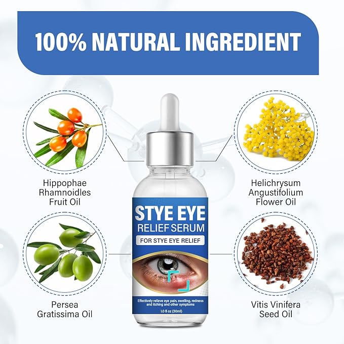 ITECFREELY Stye Eye Treatment, Natural Stye Eye Relief Drops Serum for Styes Chalazion and Blepharitis, Fast Chalazion Remover for Restore Healthier Skin-1 Fl.oz