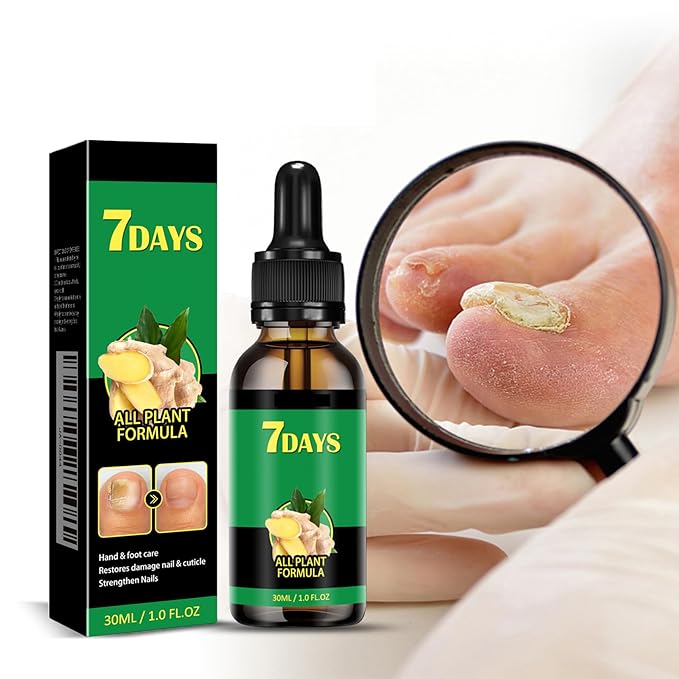 7 Days Nail Serum, Ginger Nail Serum, Ginger Nail Oil For Nail Care, Cuticle Oil, Nail Growth Serum, Ginger Nail Growth Oil, Nail Oil 2PCS