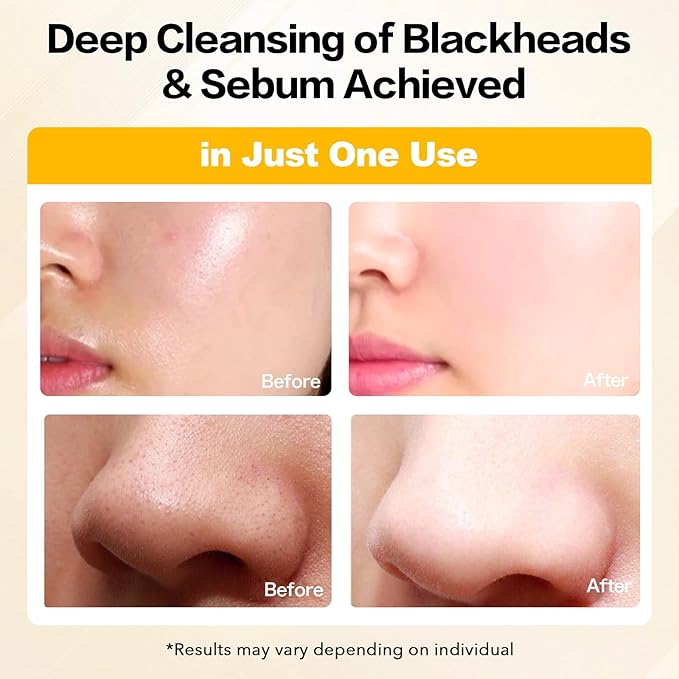 200ML Deep Cleansing Oil, Pore Control Cleanser for Face, Makeup Blackhead Remover Oil, Korean Skin Care