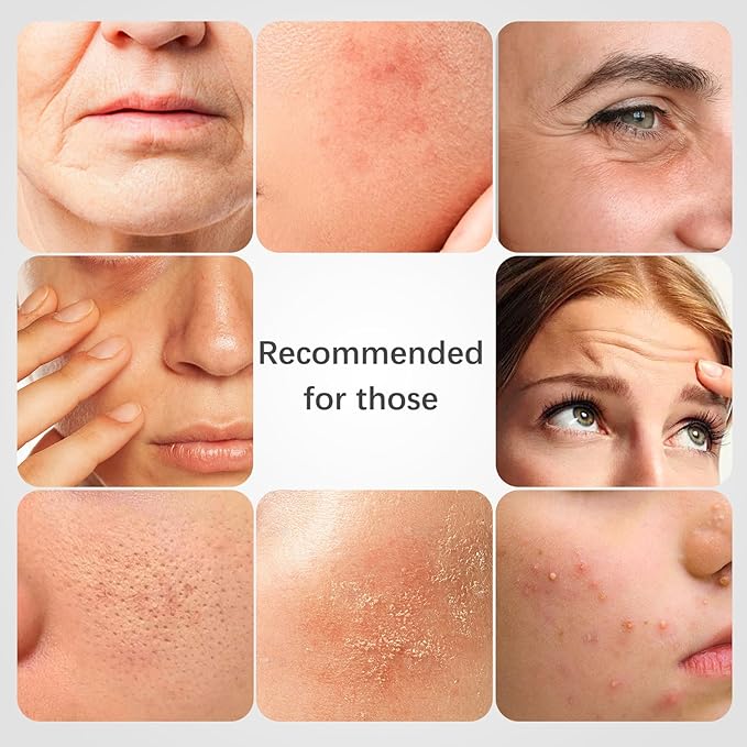 ISTON 4-in-1 Collagen Face Mask Set | Overnight Hydration & Anti-Aging Hydrogel Sheet Masks with Collagen, Hyaluronic Acid, Niacinamide, Peptides & Centella for Wrinkle Reduction& Glowing Skin