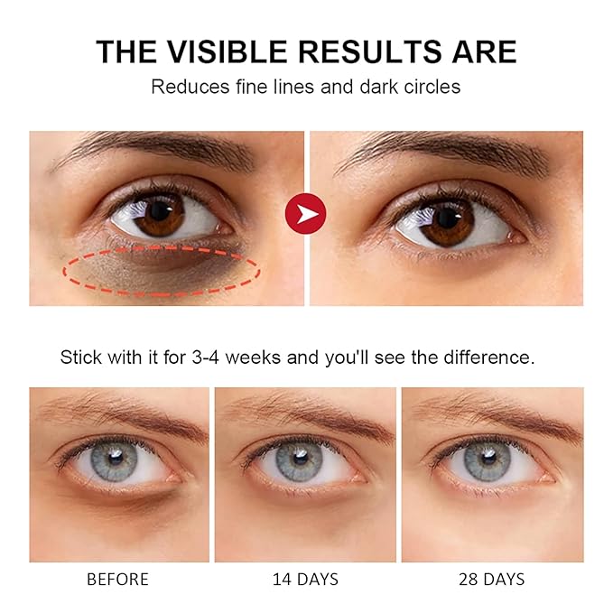 Retinol Eye Stick with Collagen,Hyaluronic Acid for Dark Circle, Wrinkles,Eye Balm Moisturizes Anti Aging,Visible Results in 3-4 Weeks, Retinol Eye Cream For Puffiness and Bags Reduces Fine Lines